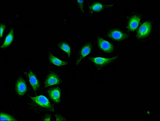 APG4B / ATG4B Antibody - Immunofluorescent analysis of A549 cells using ATG4B Antibody at a dilution of 1:100 and Alexa Fluor 488-congugated AffiniPure Goat Anti-Rabbit IgG(H+L)