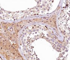 APG4B / ATG4B Antibody - 1:100 staining human Testis tissue by IHC-P. The tissue was formaldehyde fixed and a heat mediated antigen retrieval step in citrate buffer was performed. The tissue was then blocked and incubated with the antibody for 1.5 hours at 22°C. An HRP conjugated goat anti-rabbit antibody was used as the secondary.