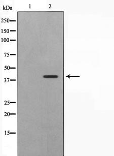 APG4B / ATG4B Antibody - Western blot analysis on Jurkat cell lysates using ATG4B antibody. The lane on the left is treated with the antigen-specific peptide.