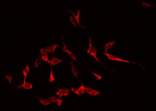 APG4B / ATG4B Antibody - Staining HeLa cells by IF/ICC. The samples were fixed with PFA and permeabilized in 0.1% Triton X-100, then blocked in 10% serum for 45 min at 25°C. The primary antibody was diluted at 1:200 and incubated with the sample for 1 hour at 37°C. An Alexa Fluor 594 conjugated goat anti-rabbit IgG (H+L) Ab, diluted at 1/600, was used as the secondary antibody.