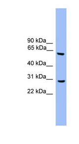 APG5 / ATG5 Antibody - ATG5 antibody Western blot of Fetal Heart lysate. This image was taken for the unconjugated form of this product. Other forms have not been tested.