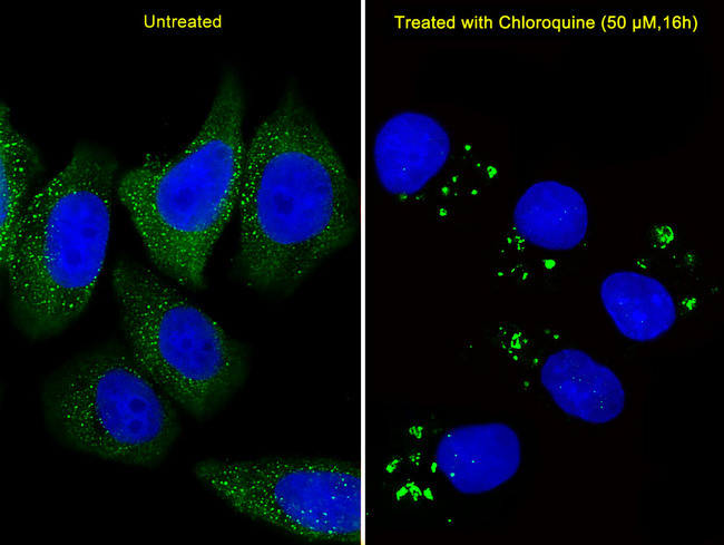 APG5 / ATG5 Antibody - Fluorescent image of U251 cells stained with ATG5 Antibody. Antibody was diluted at 1:25 dilution. U251 cells were treated with Chloroquine (50 mu M, 16h), An Alexa Fluor 488-conjugated goat anti-rabbit lgG at 1:400 dilution was used as the secondary antibody (green). DAPI was used to stain the cell nuclear (blue).
