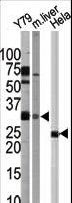 APG5 / ATG5 Antibody - Western blot of APG5L antibody in Y79 cell line, mouse liver tissue, and HeLa cell line lysates.