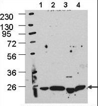APG5 / ATG5 Antibody - Cos7, HEK293, MEF, and HeLa cells left to right, respectively. Data courtesy of Drs. Jiefei Geng and Dan Klionsky, University of Michigan.
