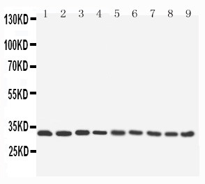 APG5 / ATG5 Antibody - WB of APG5 / ATG5 antibody. All lanes: Anti- ATG5 at 0.5ug/ml. Lane 1: Rat Liver Tissue Lysate at 4oug. Lane 2: Rat Spleen Tissue Lysate at 4oug. Lane 3: Rat Kidney Tissue Lysate at 4oug. Lane 4: HELA Whole Cell Lysate at 40ug. Lane 5: RAJI Whole Cell Lysate at 40ug. Lane 6: NIH Whole Cell Lysate at 40ug. Lane 7: HEPG2 Whole Cell Lysate at 40ug. Lane 8: PC12 Whole Cell Lysate at 40ug. Lane 9: NRK Whole Cell Lysate at 40ug. Predicted bind size: 32KD. Observed bind size: 32KD.