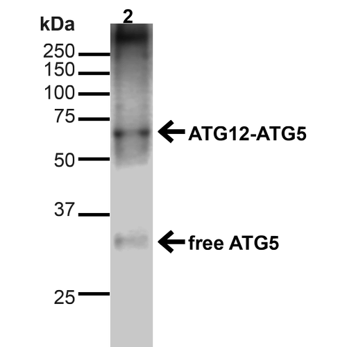 APG5 / ATG5 Antibody - Western blot analysis of Human Cervical cancer cell line (HeLa) lysate showing detection of ~15kDa ATG5 protein using Rabbit Anti-ATG5 Polyclonal Antibody. Lane 1: MW Ladder. Lane 2: Human HeLa (20 µg). Load: 20 µg. Block: 5% milk + TBST for 1 hour at RT. Primary Antibody: Rabbit Anti-ATG5 Polyclonal Antibody  at 1:1000 for 1 hour at RT. Secondary Antibody: Goat Anti-Rabbit: HRP at 1:2000 for 1 hour at RT. Color Development: TMB solution for 12 min at RT. Predicted/Observed Size: ~15kDa. Other Band(s): ATG12-ATG5 Complex.