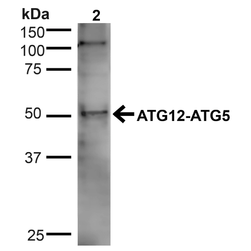 APG5 / ATG5 Antibody - Western blot analysis of Human Cervical cancer cell line (HeLa) lysate showing detection of ~32.4kDa ATG5 protein using Rabbit Anti-ATG5 Polyclonal Antibody. Lane 1: MW Ladder. Lane 2: Human HeLa (20 µg). Load: 20 µg. Block: 5% milk + TBST for 1 hour at RT. Primary Antibody: Rabbit Anti-ATG5 Polyclonal Antibody  at 1:1000 for 1 hour at RT. Secondary Antibody: Goat Anti-Rabbit: HRP at 1:2000 for 1 hour at RT. Color Development: TMB solution for 12 min at RT. Predicted/Observed Size: ~32.4kDa. Other Band(s): ~105kDa.