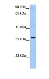 APG5 / ATG5 Antibody - HepG2 cell lysate. Antibody concentration: 1.0 ug/ml. Gel concentration: 12%.  This image was taken for the unconjugated form of this product. Other forms have not been tested.
