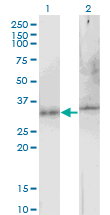 APG5 / ATG5 Antibody - Western blot of ATG5 expression in transfected 293T cell line by ATG5 monoclonal antibody (M02), clone 1C4.
