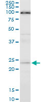 APG5 / ATG5 Antibody - ATG5 monoclonal antibody (M05), clone 1E7. Western blot of ATG5 expression in NIH/3T3.