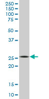 APG5 / ATG5 Antibody - ATG5 monoclonal antibody (M04), clone 1G11. Western blot of ATG5 expression in Jurkat.
