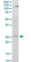 APG5 / ATG5 Antibody - ATG5 monoclonal antibody (M04), clone 1G11. Western blot of ATG5 expression in NIH/3T3.