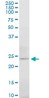 APG5 / ATG5 Antibody - ATG5 monoclonal antibody (M06), clone 3G11. Western blot of ATG5 expression in Raw 264.7.