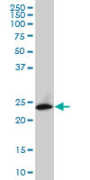 APG5 / ATG5 Antibody - ATG5 monoclonal antibody (M06), clone 3G11. Western blot of ATG5 expression in Jurkat.