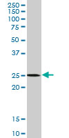 APG5 / ATG5 Antibody - ATG5 monoclonal antibody (M10), clone 4B7. Western blot of ATG5 expression in Jurkat.
