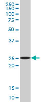 APG5 / ATG5 Antibody - ATG5 monoclonal antibody (M09), clone 4E7. Western blot of ATG5 expression in Jurkat.