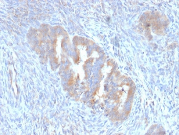 APG5 / ATG5 Antibody - IHC staining of FFPE human endometrium with ATG5 antibody (clone ATG5/2101). Required HIER: boil tissue sections in 10mM citrate buffer, pH 6, for 10-20 min followed by cooling at RT for 20 min.