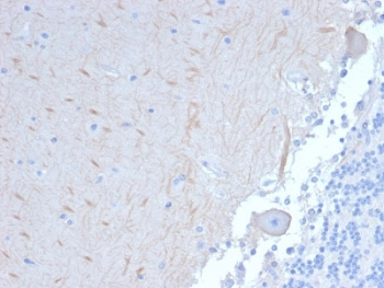 APG5 / ATG5 Antibody - IHC staining of FFPE human brain with ATG5 antibody (clone ATG5/2101). Required HIER: boil tissue sections in 10mM citrate buffer, pH 6, for 10-20 min followed by cooling at RT for 20 min.