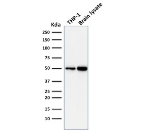 APG5 / ATG5 Antibody - Western blot testing of human THP1 and human brain lysate with ATG5 antibody (clone ATG5/2101). Expected molecular weight ATG5: ~32 kDa; ATG5/ATG12 heterodimer: ~56 kDa.