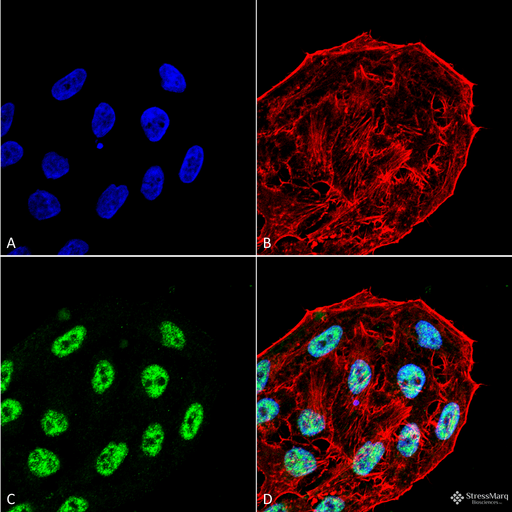 APG5 / ATG5 Antibody - Immunocytochemistry/Immunofluorescence analysis using Rabbit Anti-ATG5 Polyclonal Antibody. Tissue: Cervical cancer cell line (HeLa). Species: Human. Fixation: 4% Formaldehyde for 15 min at RT. Primary Antibody: Rabbit Anti-ATG5 Polyclonal Antibody  at 1:100 for 60 min at RT. Secondary Antibody: Goat Anti-Rabbit ATTO 488 at 1:100 for 60 min at RT. Counterstain: Phalloidin Texas Red F-Actin stain; DAPI (blue) nuclear stain at 1:1000, 1:5000 for 60min RT, 5min RT. Localization: Nucleus, Cytoplasm. Magnification: 40X. (A) DAPI (blue) nuclear stain (B) Phalloidin Texas Red F-Actin stain (C) ATG5 Antibody (D) Composite.