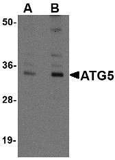 APG5 / ATG5 Antibody - Western blot of ATG5 in mouse spleen tissue lysate with ATG5 antibody at (A) 1 and (B) 2 ug/ml. Below: Immunohistochemistry of ATG5 in human spleen tissue with ATG5 antibody at 2.5 ug/ml.