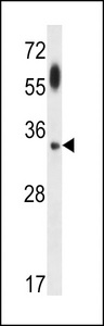 APG5 / ATG5 Antibody - ATG5 Antibody western blot of uterus tumor cell line lysates (35 ug/lane). The ATG5 antibody detected the ATG5 protein (arrow).