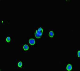 APG5 / ATG5 Antibody - Immunofluorescent analysis of MCF-7 cells using ATG5 Antibody at dilution of 1:100 and Alexa Fluor 488-congugated AffiniPure Goat Anti-Rabbit IgG(H+L)