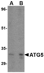 APG5 / ATG5 Antibody - Western blot of ATG5 in rat spleen tissue lysate with ATG5 antibody at (A) 1 and (B) 2 ug/ml.