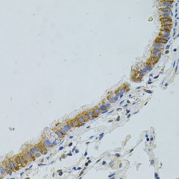 APG5 / ATG5 Antibody - Immunohistochemistry of paraffin-embedded human lung using ATG5 antibody at dilution of 1:100 (40x lens).