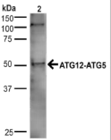 APG5 / ATG5 Antibody - Detection of Atg5-ATG12 in 20ug of HeLa cell lysate.