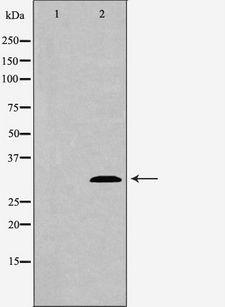 APG5 / ATG5 Antibody - Western blot analysis of extracts of mouse spleen tissue using ATG5 antibody. The lane on the left is treated with the antigen-specific peptide.
