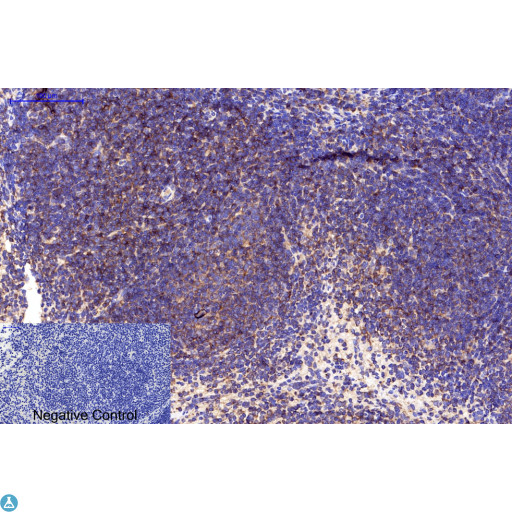 APG5 / ATG5 Antibody - Immunohistochemical analysis of mouse spleen tissue. Anti-ATG5 at 1:200 (4°C, overnight). Antigen retrieval - Sodium Citrate pH6 (>98°C, 20min). Secondary - 1:200 (room temp, 30min). Negative control - Secondary only