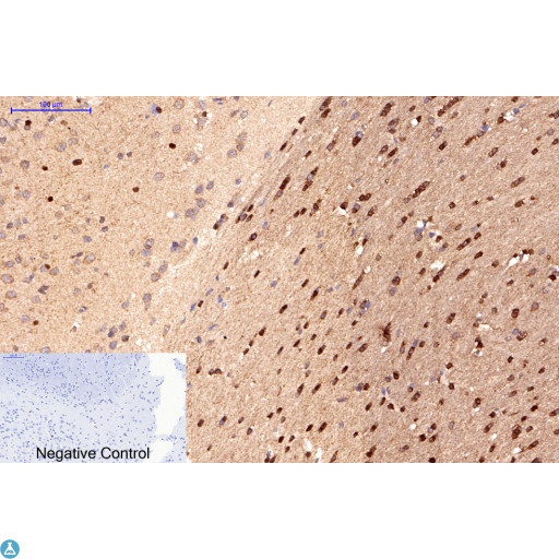APG5 / ATG5 Antibody - Immunohistochemical analysis of rat brain tissue. STJ98903 was diluted at 1:200 (4°C, overnight). Sodium citrate pH6.0 was used for antibody retrieval (>98°C, 20min). Secondary antibody was diluted at 1:200 (room temperature, 30min). Negative control plate was secondary antibody only.
