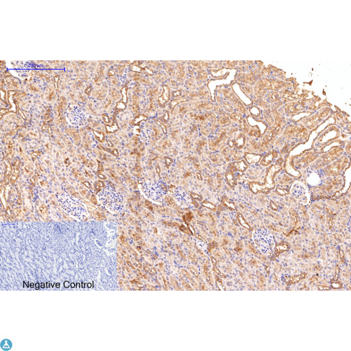 APG5 / ATG5 Antibody - Immunohistochemical analysis of rat kidney tissue. STJ98903 was diluted at 1:200 (4°C, overnight). Sodium citrate pH6.0 was used for antibody retrieval (>98°C, 20min). Secondary antibody was diluted at 1:200 (room temperature, 30min). Negative control plate was secondary antibody only.