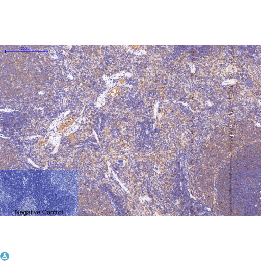 APG5 / ATG5 Antibody - Immunohistochemical analysis of rat spleen tissue. STJ98903 was diluted at 1:200 (4°C, overnight). Sodium citrate pH6.0 was used for antibody retrieval (>98°C, 20min). Secondary antibody was diluted at 1:200 (room temperature, 30min). Negative control plate was secondary antibody only.
