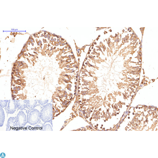 APG5 / ATG5 Antibody - Immunohistochemical analysis of rat testis tissue. STJ98903 was diluted at 1:200 (4°C, overnight). Sodium citrate pH6.0 was used for antibody retrieval (>98°C, 20min). Secondary antibody was diluted at 1:200 (room temperature, 30min). Negative control plate was secondary antibody only.