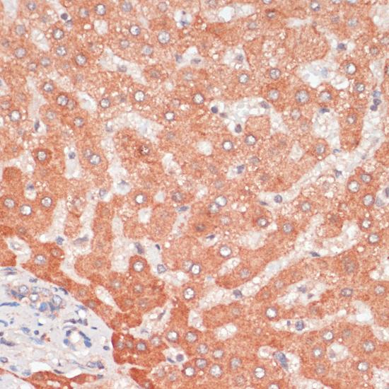 APG5 / ATG5 Antibody - Immunohistochemistry of paraffin-embedded Human liver using ATG5 Polyclonal Antibody at dilution of 1:100 (40x lens).