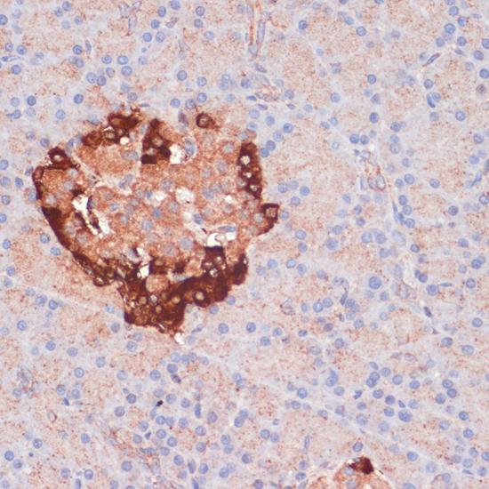 APG5 / ATG5 Antibody - Immunohistochemistry of paraffin-embedded Rat pancreas using ATG5 Polyclonal Antibody at dilution of 1:100 (40x lens).