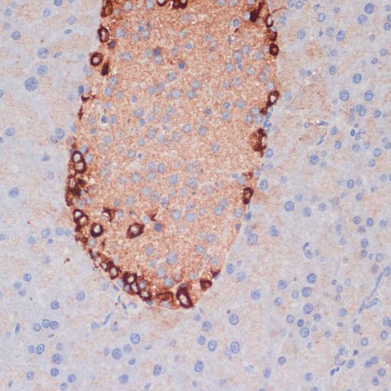 APG5 / ATG5 Antibody - Immunohistochemistry of paraffin-embedded Mouse pancreas using ATG5 Polyclonal Antibody at dilution of 1:100 (40x lens).