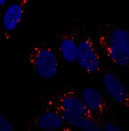APG5 / ATG5 Antibody - Immunocytochemistry/Immunofluorescence: ATG5 Antibody - Staining of SY5Y cells using ATG5 antibody at 1:250. Incubated overnight at 4 degrees.  This image was taken for the unconjugated form of this product. Other forms have not been tested.