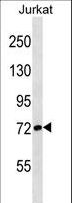Apg7 / ATG7 Antibody - APG7L Antibody (E37) western blot of Jurkat cell line lysates (35 ug/lane). The APG7L antibody detected the APG7L protein (arrow).