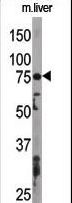 Apg7 / ATG7 Antibody - The anti-APG7L antibody is used in Western blot to detect APG7L in mouse liver tissue lysate. APG7L(arrow) was detected using the purified antibody.