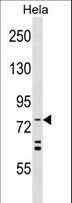 Apg7 / ATG7 Antibody - APG7L Antibody (R509) western blot of HeLa cell line lysates (35 ug/lane). The APG7L antibody detected the APG7L protein (arrow).