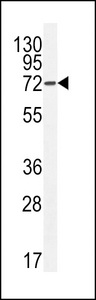 Apg7 / ATG7 Antibody - hAPG7L-D555 (PEI 1:100)b western blot of HeLa cell line lysates (35 ug/lane). The APG7L antibody detected the APG7L protein (arrow).
