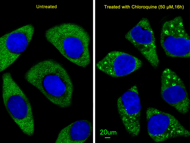 Apg7 / ATG7 Antibody - Immunofluorescence of U251 cells, using ATG7 Antibody. U251 cells(right) were treated with Chloroquine (50 mu M,16h). Antibody was diluted at 1:25 dilution. Alexa Fluor 488-conjugated goat anti-rabbit lgG at 1:400 dilution was used as the secondary antibody (green). DAPI was used to stain the cell nuclear (blue).
