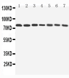 Apg7 / ATG7 Antibody - WB of Apg7 / ATG7 antibody. All lanes: Anti-ATG7 at 0.5ug/ml. Lane 1: Rat Liver Tissue Lysate at 40ug. Lane 2: Rat Kidney Tissue Lysate at 40ug. Lane 3: Human Placenta Tissue Lysate at 40ug. Lane 4: HELA Whole Cell Lysate at 40ug. Lane 5: JURKAT Whole Cell Lysate at 40ug. Lane 6: 293T Whole Cell Lysate at 40ug. Lane 7: HEPG2 Whole Cell Lysate at 40ug. Predicted bind size: 78KD. Observed bind size: 78KD.