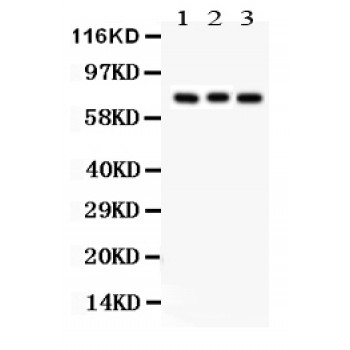 Apg7 / ATG7 Antibody - APG7 antibody Western blot. All lanes: Anti APG7 at 0.5 ug/ml. Lane 1: Rat Brain Tissue Lysate at 50 ug. Lane 2: Mouse Brain Tissue Lysate at 50 ug. Lane 3: 293T Whole Cell Lysate at 40 ug. Predicted band size: 78 kD. Observed band size: 78 kD.