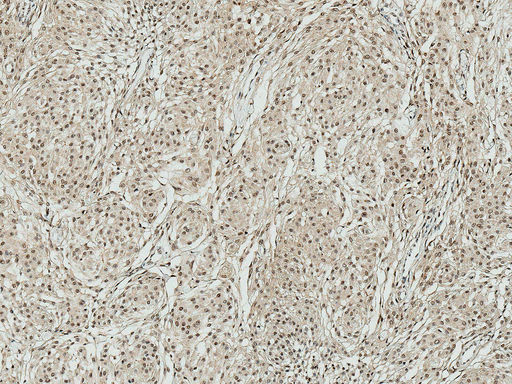 Apg7 / ATG7 Antibody - Immunohistochemistry analysis using Rabbit Anti-ATG10 Polyclonal Antibody. Tissue: Brain. Species: Human. Fixation: Formalin Fixed Paraffin-Embedded. Primary Antibody: Rabbit Anti-ATG10 Polyclonal Antibody  at 1:50 for 30 min at RT. Counterstain: Hematoxylin. Magnification: 10X.