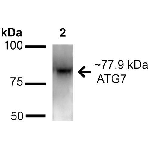 Apg7 / ATG7 Antibody - Western blot analysis of Mouse and rat brain cell lysates showing detection of ~77.9 kDa ATG7 protein using Rabbit Anti-ATG7 Polyclonal Antibody. Lane 1: Molecular Weight Ladder. Lane 2: Mouse brain cell lysates. Lane 3: Rat brain cell lysates. Load: 20 µg. Block: 2% BSA and 2% Skim Milk in 1X TBST. Primary Antibody: Rabbit Anti-ATG7 Polyclonal Antibody  at 1:1000 for 16 hours at 4°C. Secondary Antibody: Goat Anti-Rabbit IgG: HRP at 1:2000 for 60 min at RT. Color Development: ECL solution for 6 min at RT. Predicted/Observed Size: ~77.9 kDa.