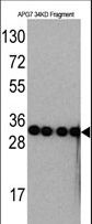 Apg7 / ATG7 Antibody - Western blot of anti-APG7 Monoclonal Antibody by Recombinant APG7 protein (Fragment 34KD). APG7 protein (Fragment 34KD)(arrow) was detected using the ascites antibody.